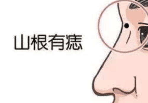 山根有痣的男人好吗 山根有痣的女人代表什么
